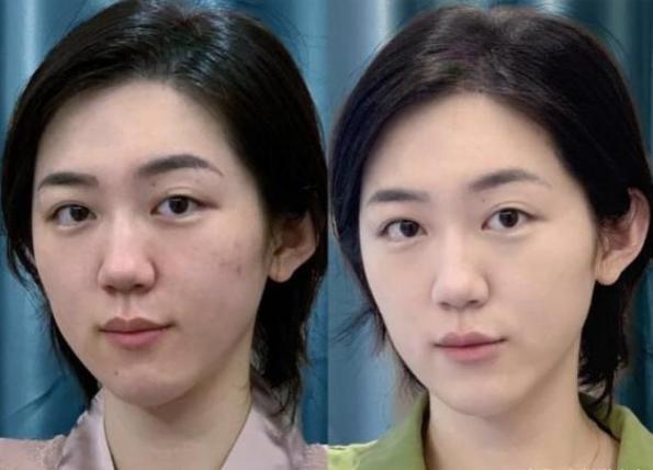 不要羡慕那些外表光鲜亮丽的女人,澳洲绵羊油适合油性皮肤的人用吗