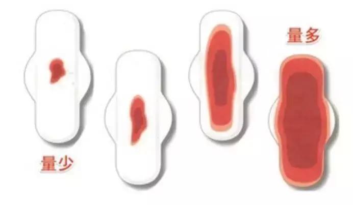 女子深夜出血检查出宫颈癌,28岁女子查出宫颈癌的4个征兆