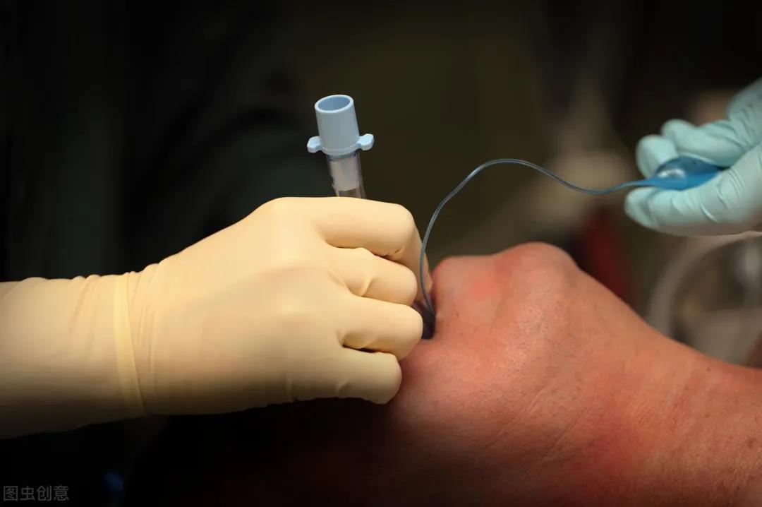 40岁女因脾气暴躁2次手术，最后一次差点毙命，医生切开她喉咙