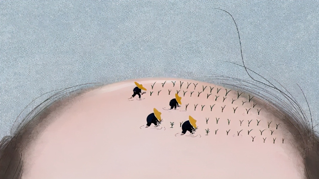 医生头发秃顶,医生都秃头吗