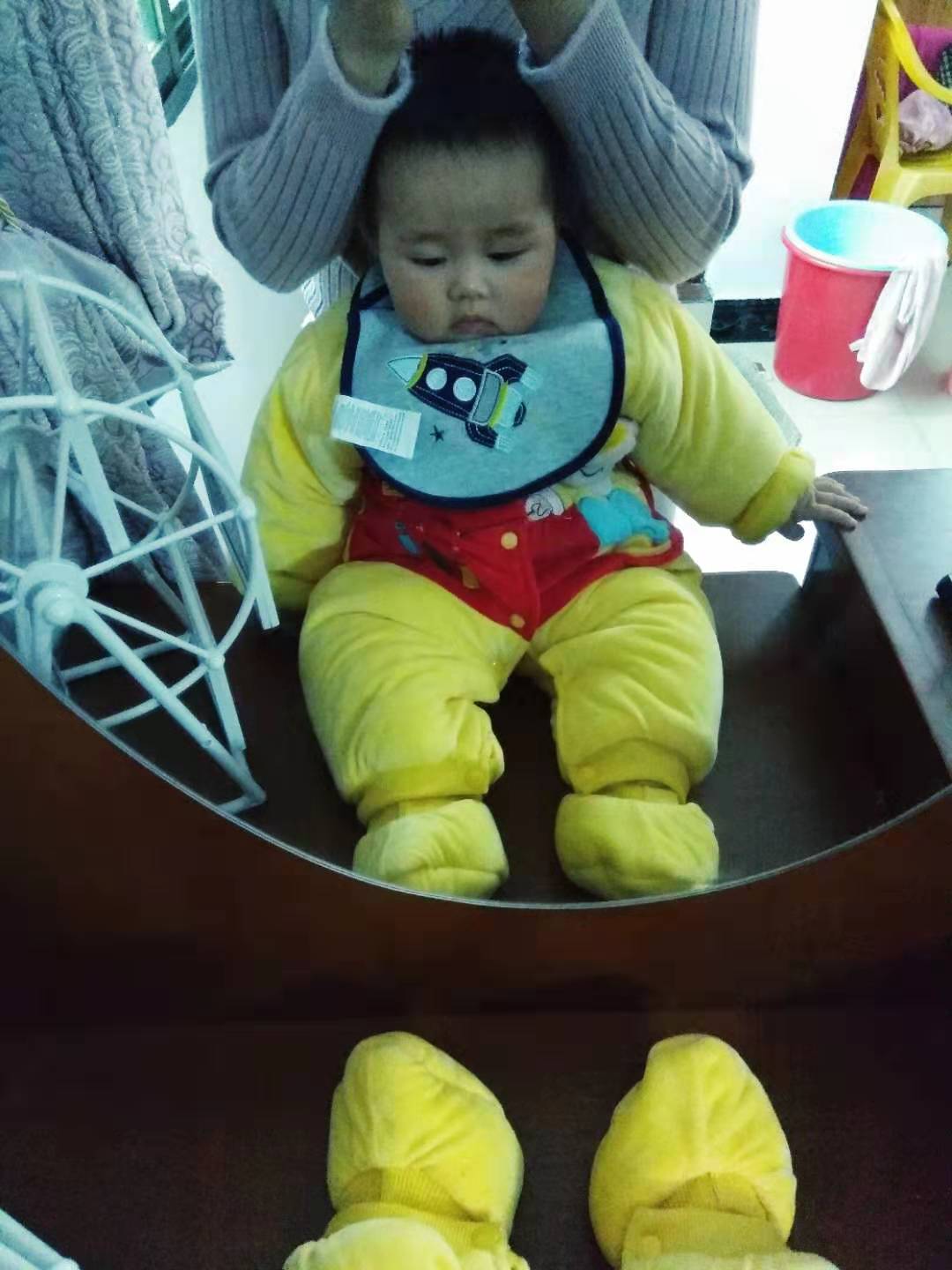 宝宝食物过敏怎么急救,婴儿对蛋白质过敏宝妈应忌食什么