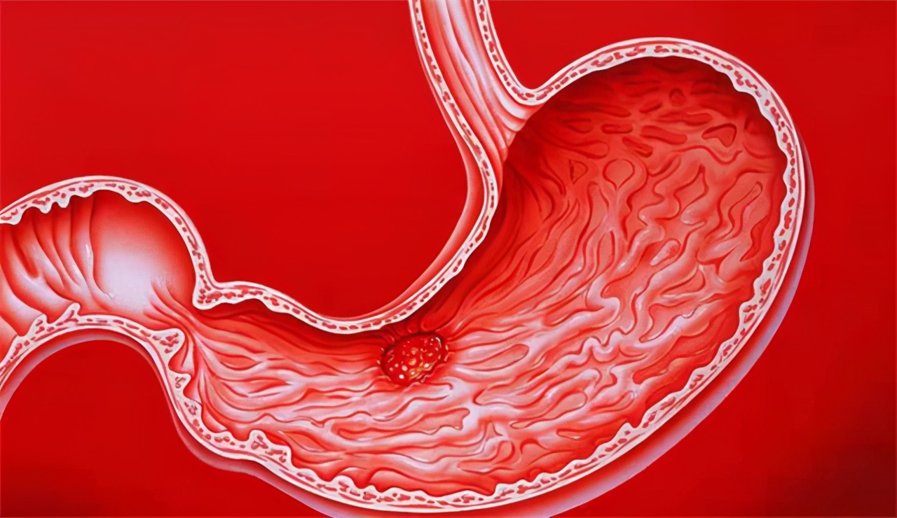 胃酸烧心吃奥美拉唑要吃多长时间,胃酸烧心吃奥美拉唑可以吗