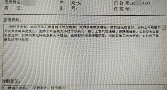 50岁女肺部8毫米结节治疗过程,女士肺结节康复