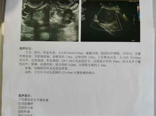 疾病中隐藏最深的“杀手”---痛经,你还不当回事吗?