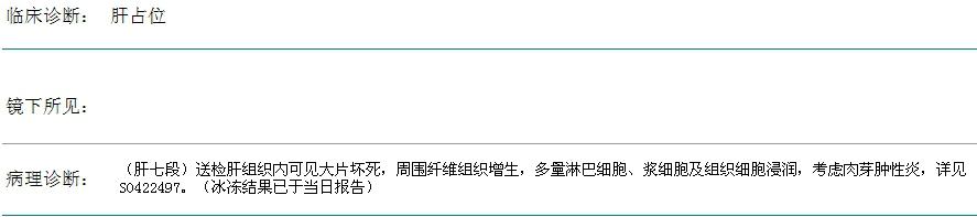 真假肿瘤实例！皆大欢喜背后源自于永不放弃