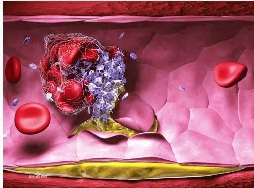 红点消失后皮肤变成褐色,红点出现又消失