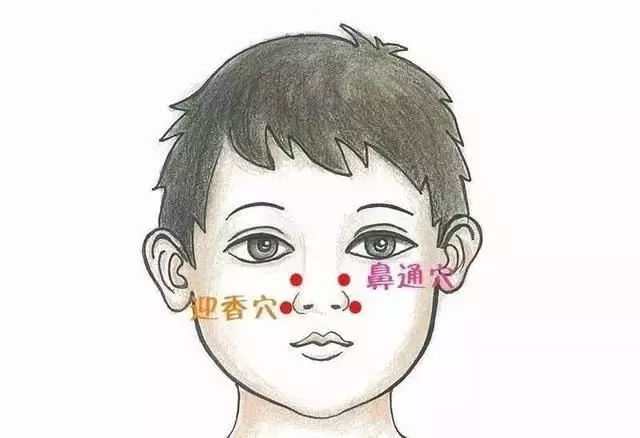 艾灸迎香穴治鼻炎视频,过敏性鼻炎可以按迎香穴吗