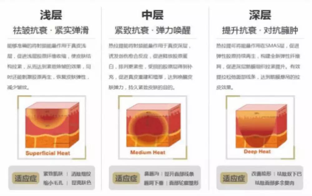 热拉提超声刀热玛吉,超声刀热玛吉真的有用吗