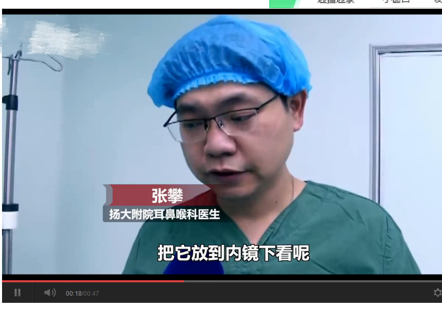 男子检查耳朵发现活蜘蛛,男子耳朵奇痒难忍竟是里面长霉了