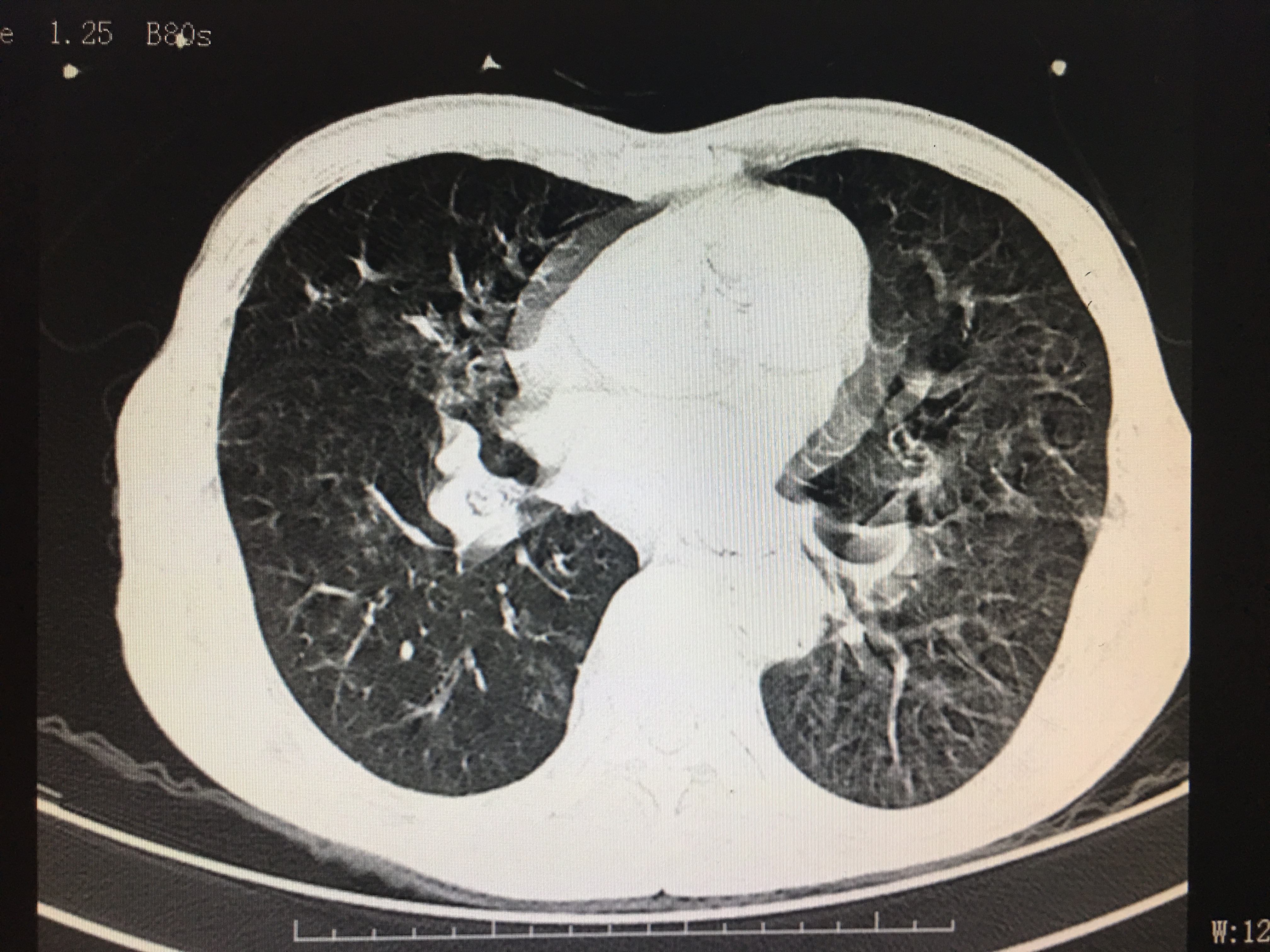 医生说的检查项目我们都必须做吗,医生告诉你应该做哪些检查