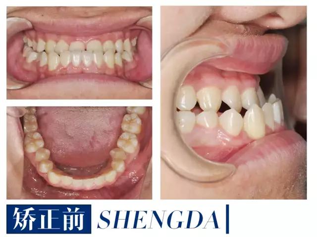 山西“爱马仕”级别齿科医院!get明星同款笑容