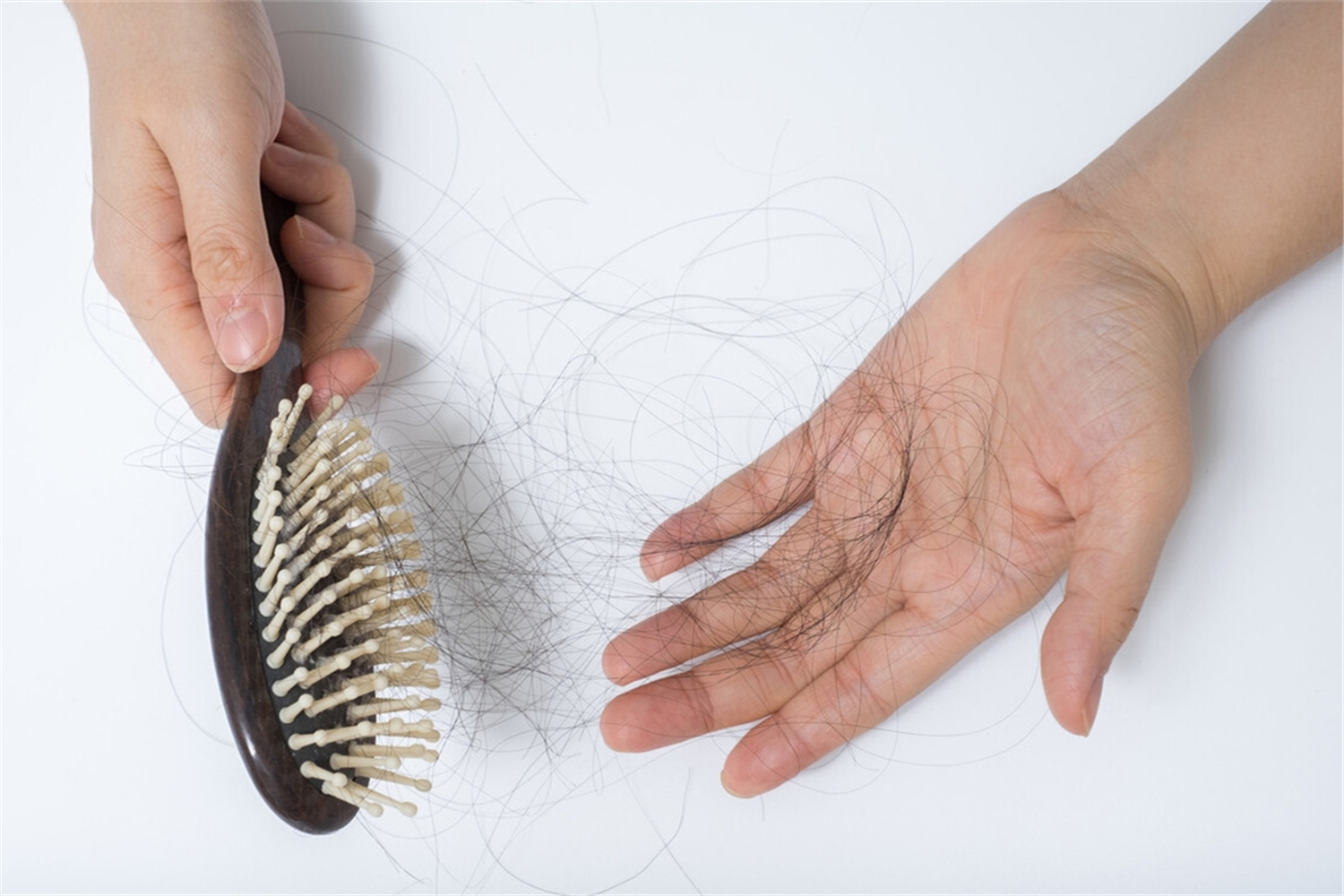 张歆艺产后掉发,张歆艺产后脱发