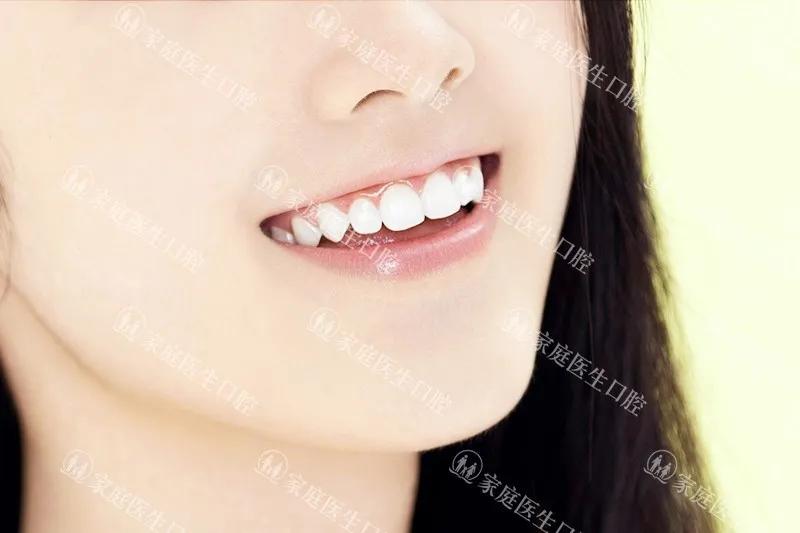 矫正牙齿详细流程,最新最安全有效的牙齿矫正方法