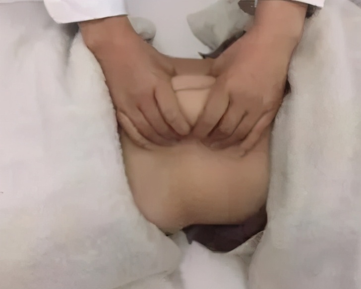 三指半到闭合,一个双胞胎妈妈的腹直肌康复之路