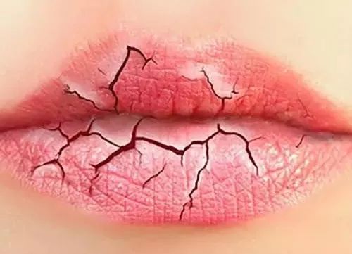 嘴唇总起皮器官发出信号,嘴唇干裂代表哪个脏腑