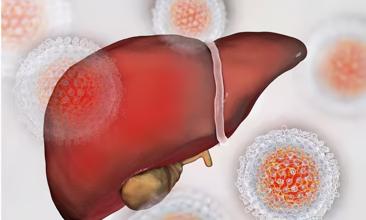 肝病已痊愈能吃护肝药吗,肝病最好护肝药