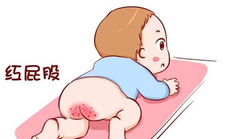 新生儿红屁股有泡,新生儿有红屁股怎么办