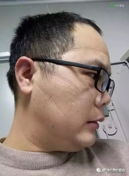 离病毒最近的人,离病毒最近的疾控人