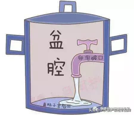 小腹坠胀感觉有东西要掉出来,小腹坠胀流了一点血