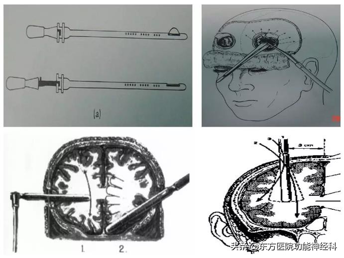精神病人的前世,精神科药物的前世今生