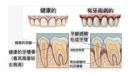 大连齿医生口腔科普没有蛀牙还牙疼？这4个隐患不能忽视