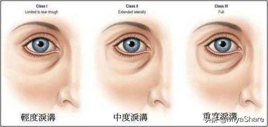 去黑眼圈的眼霜测评第一名有效,去黑眼圈公认最好用的10大眼霜