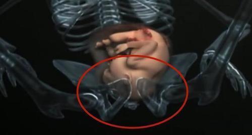 产道那么小怎么顺产,产道那么小胎儿怎么出来的