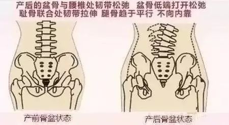 自治区中医院开发区医院｜“笑尿了”女性朋友要注意