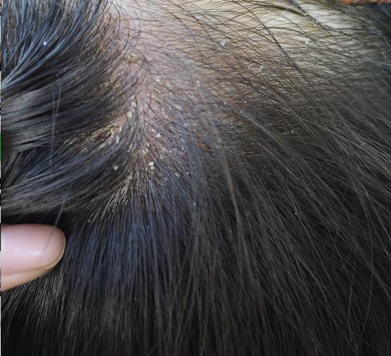 洗发水买无硅油的还是含硅油的,无硅油洗发水好还是有硅油的好