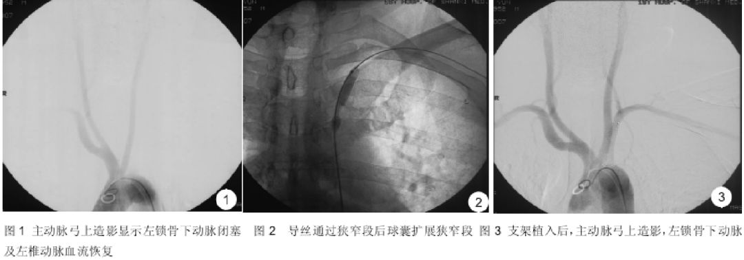 一手防守一手攻击防身术,一手持棒一手握盾训练