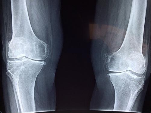 关节疼痛用氨糖软骨素好吗,氨糖可以治疗关节疼痛吗