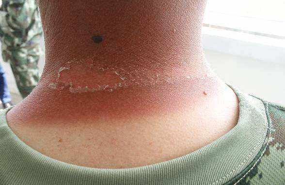 好用不过敏的儿童防晒,防晒良心亲测