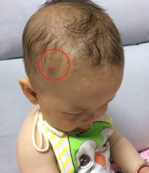 婴儿10个月剃头发技巧,宝宝满月剃头怎么讲究