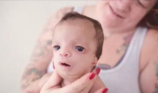 你还在给宝宝盲目补钙吗,你还在给孩子补钙吗