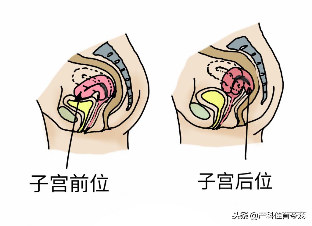 子宫内膜薄在b超上怎样显示的,子宫内膜在b超上怎么显示