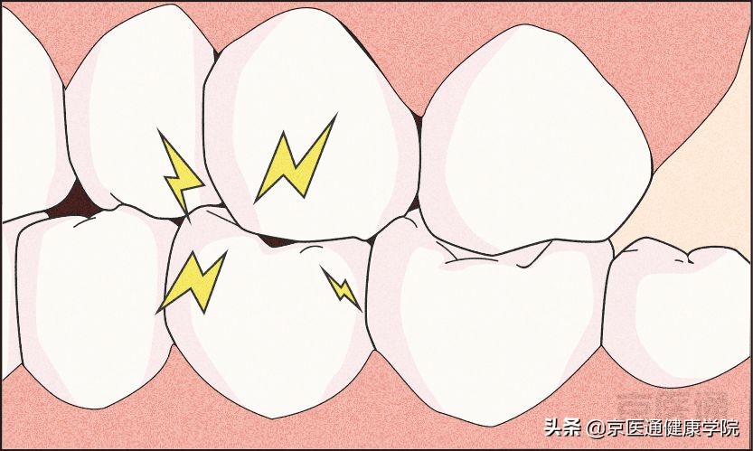 夜磨牙有什么危害吗,夜磨牙的危害