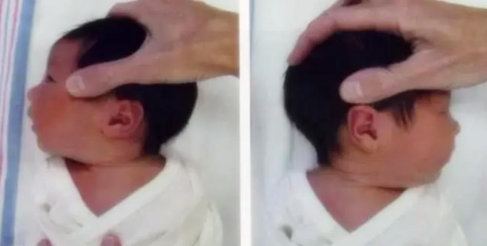 孩子头型偏了是不是扎辫子都不正,5个月宝宝头型不正还可以纠正吗