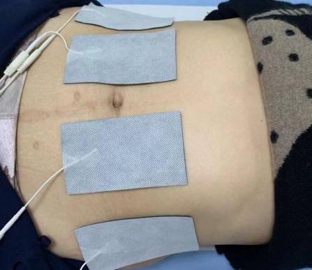 产后康复是怎么做的,中医康复和产后康复哪个最好