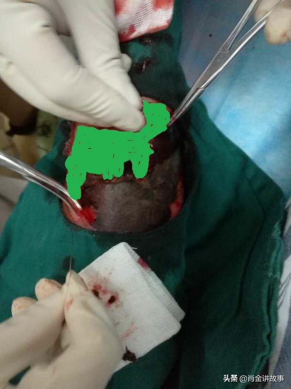 中国好人丁伟强,丁伟强医生