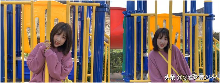 不靠整容怎么改变下巴后缩?看这里