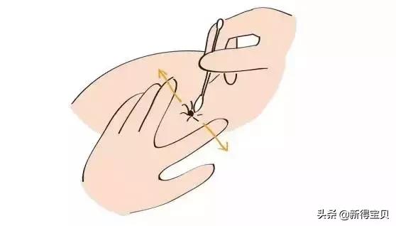 月嫂护理孩子肚脐的视频,婴儿脐部护理的实操