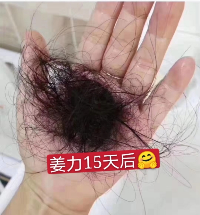 姜力洗发水防脱效果好吗,姜力一号生发洗发水