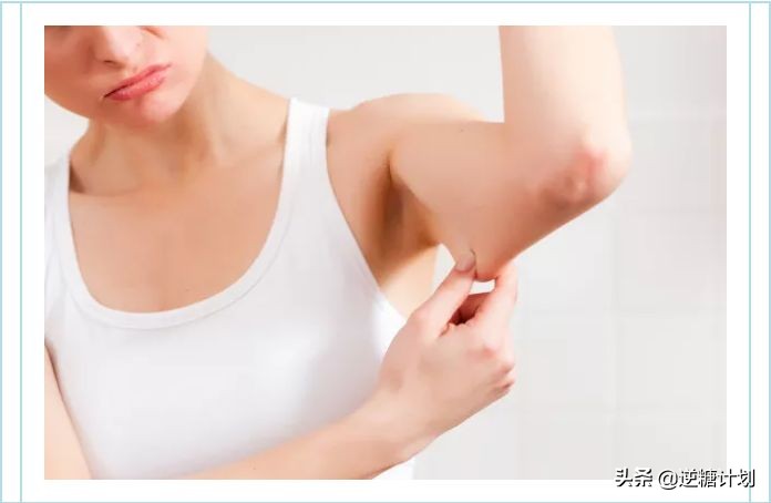 50岁女性如何补钙对抗骨质疏松,骨质疏松什么程度才可以打补钙针