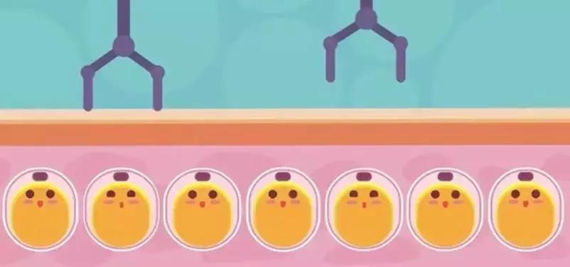 “减肥靠运动”，这句话误导了我们多少年