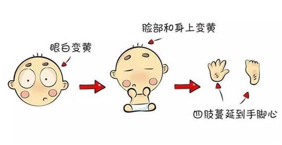 孩子出生后黄疸是怎么回事,孩子出生后变得很黄是为什么