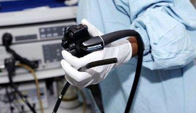 一般不建议年轻人做普通胃镜,一般不建议年轻人做胃镜