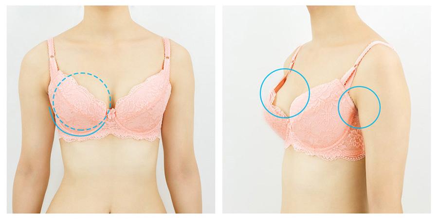 少一个乳房适合选什么内衣,适合乳房内陷的内衣