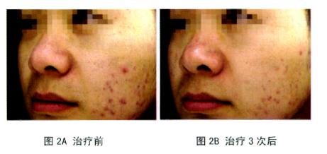 现在最流行医美项目是什么,公认比较有效的医美项目