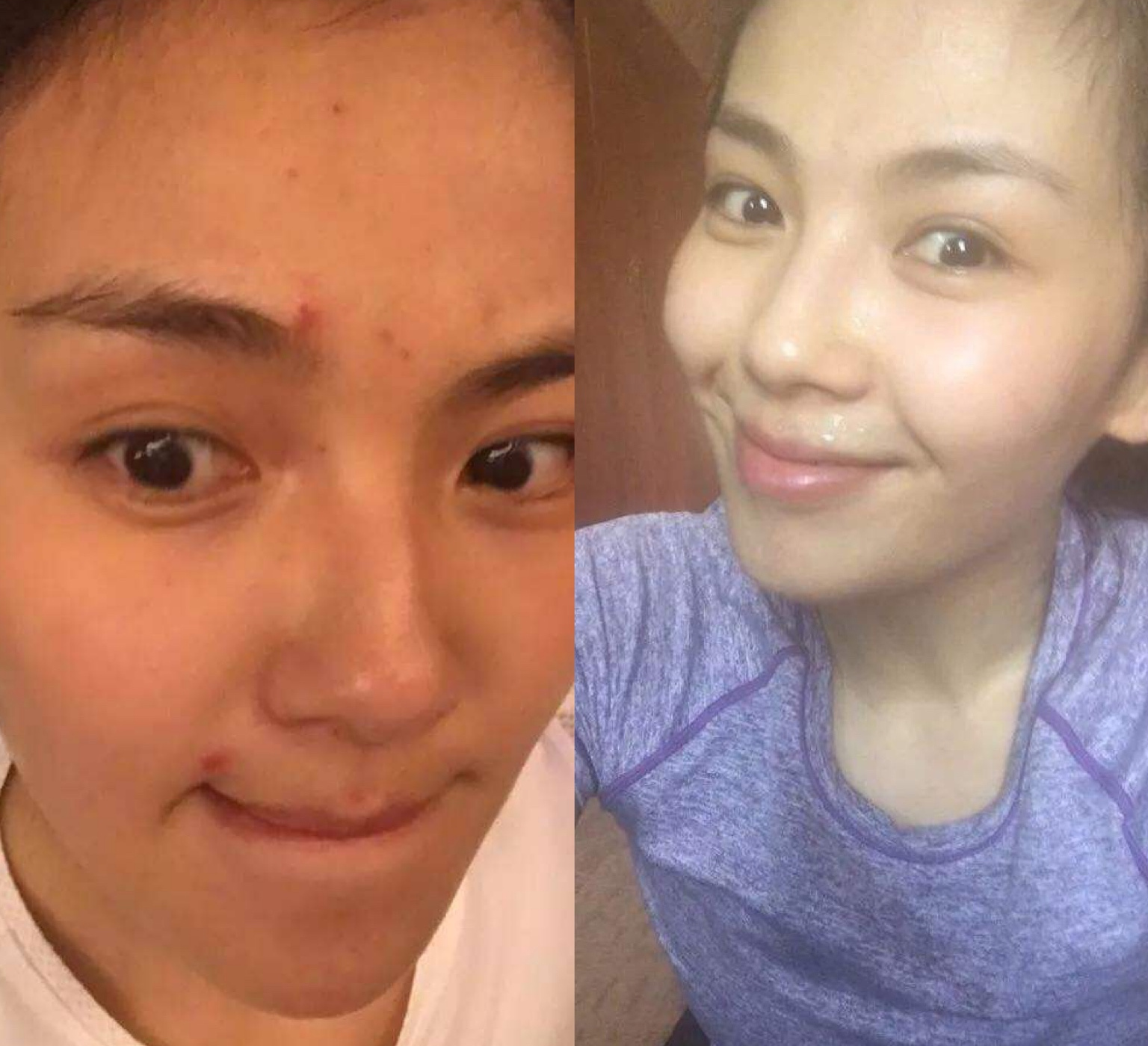 胶原蛋白如何补,胶原蛋白应该怎么补