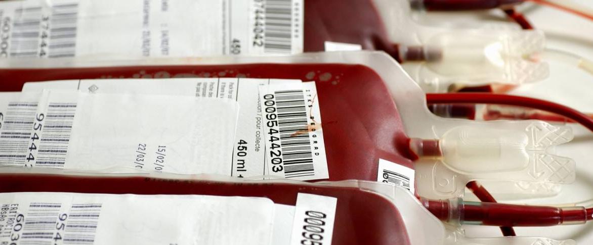 输血过程中发生溶血反应如何急救,输血发生抽搐的原因